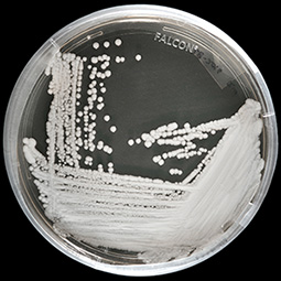 candida auris culture at the CDC